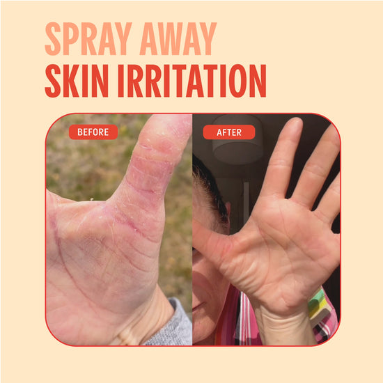 hypochlorous acid facial mist hands before after