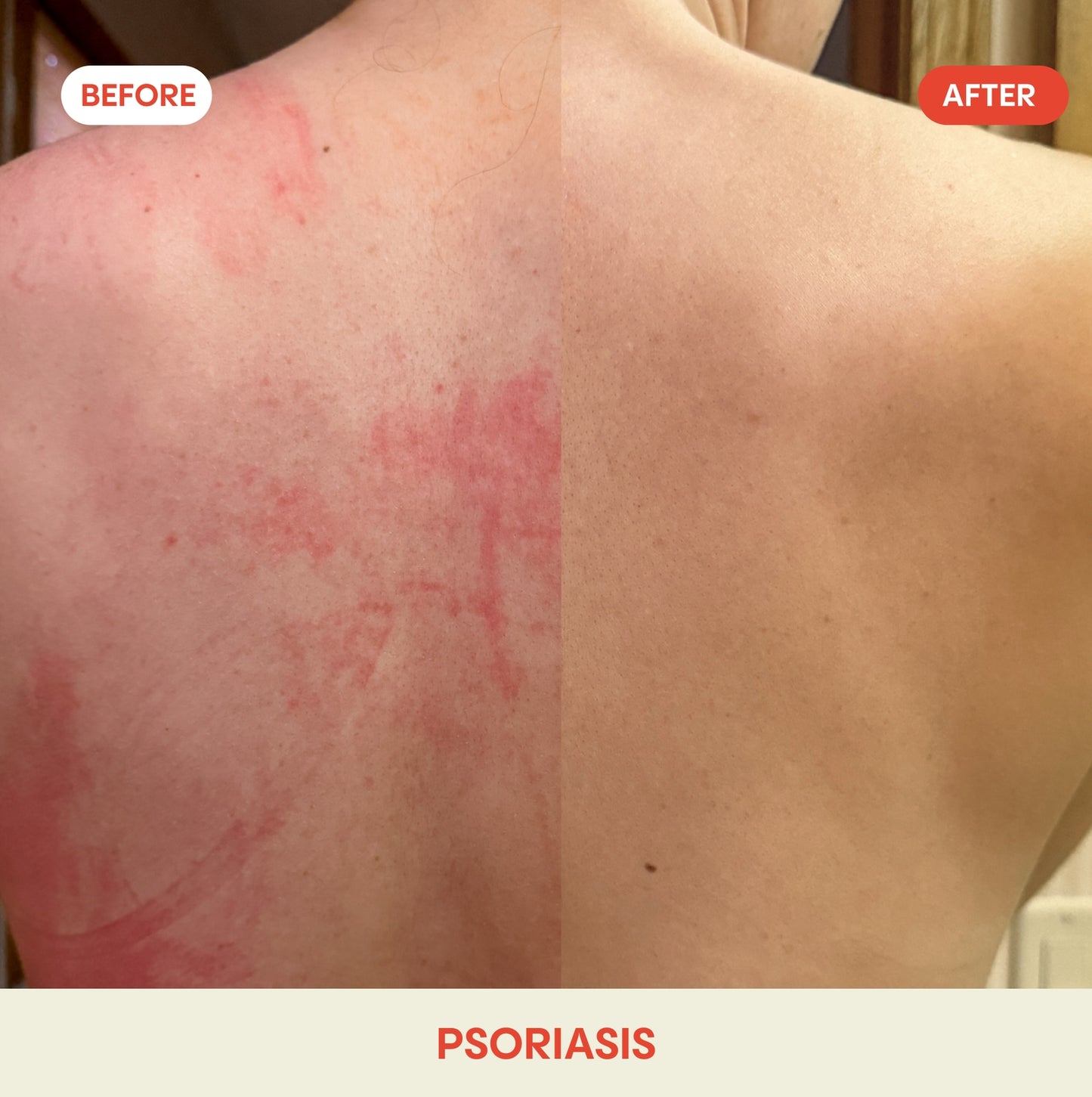 Hypochlorous Acid Facial Spray