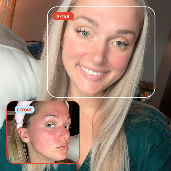 hypochlorous acid facial mist customer results